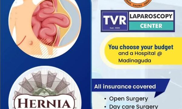 tvr laproscopy – varun raj