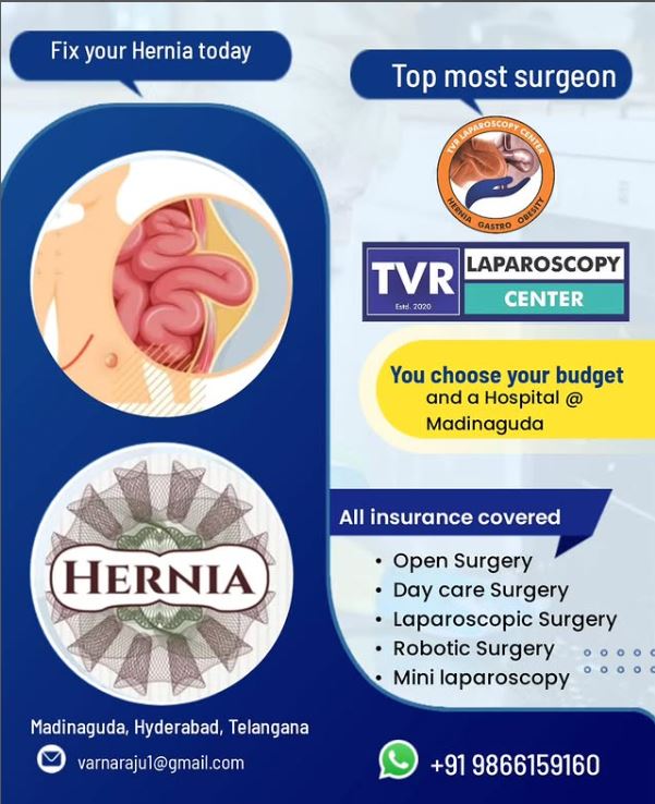 tvr laproscopy – varun raj